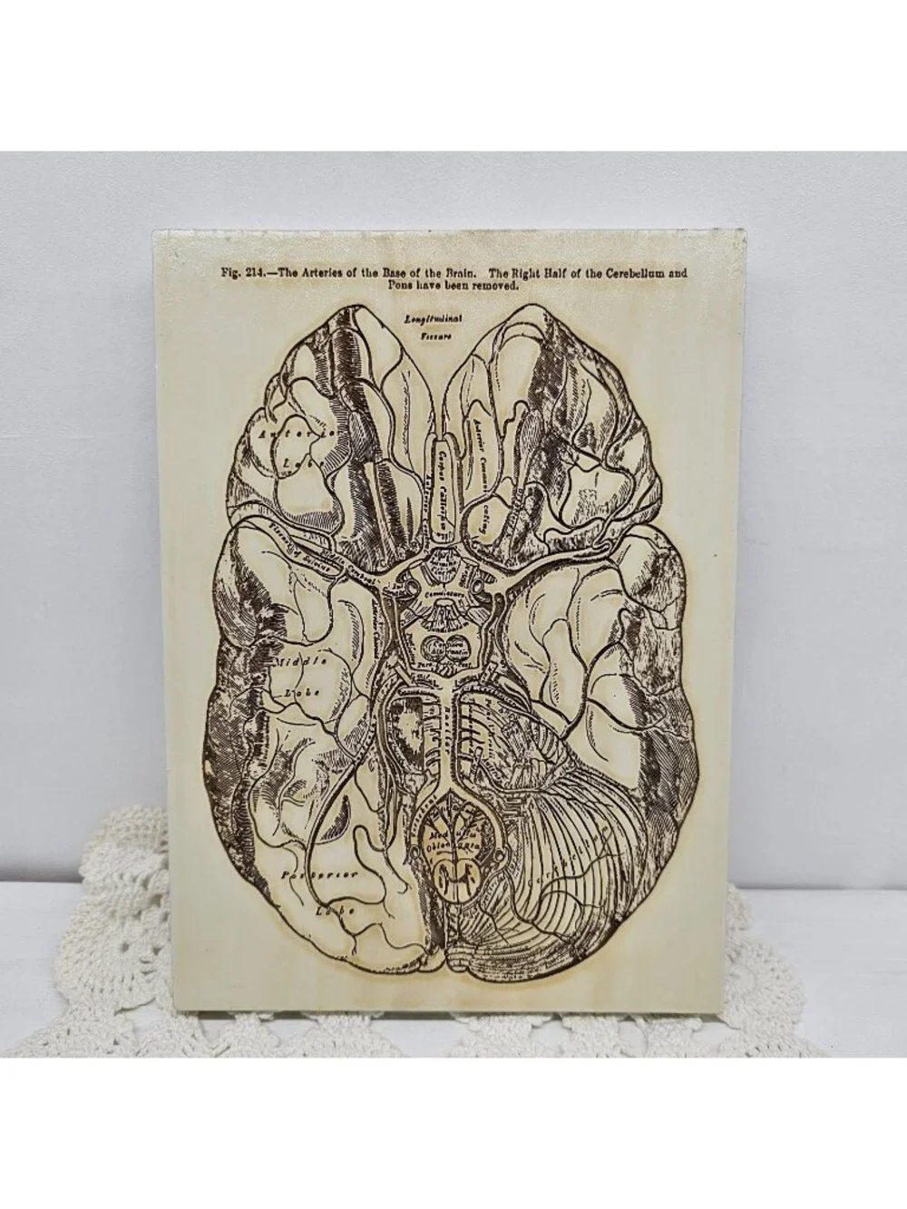 Vintage Gray’s Anatomy Brain Arteries Wood Wall Plaque Medical Art Doctor Gift